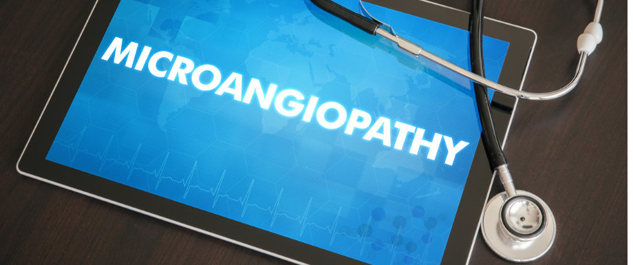 Microangiopathy Symptoms